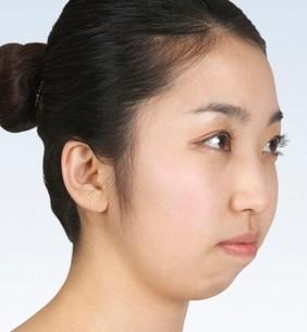 裂下巴的女人命运