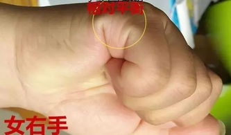 断掌纹的男人命运