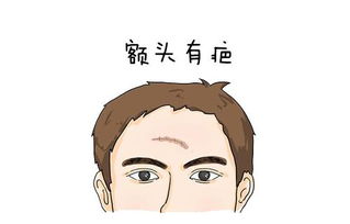 额头上有疤的人命运