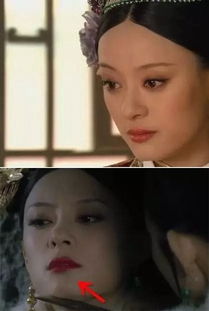 有媒婆痣的女人命运