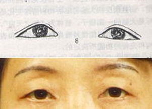 三角眼睛人命运