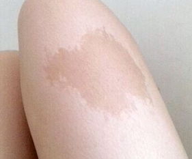 大腿上有胎记的人命运
