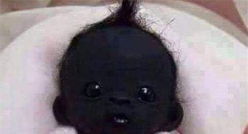 少白发的人命运