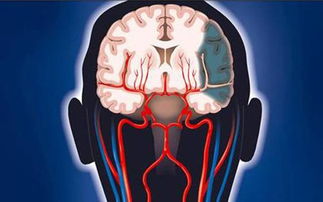 脑梗塞食谱大全