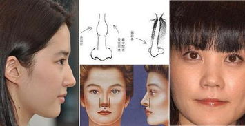 鼻子有胎记的女人命运