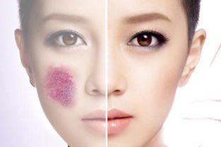 腰上有胎记女人命运