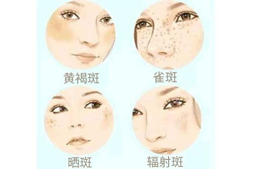 轻度鞍鼻女人命运