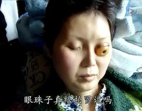 鱼眼的女人命运