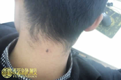 苦情痣人命运怎样