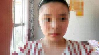 额头肉多的人命运如何