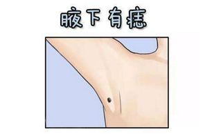 腋下长痣的人命运如何