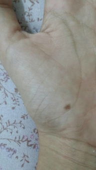 左手指有痣的女人命运