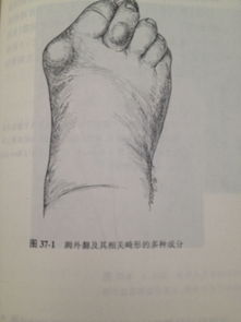 脚孤拐的人命运不好吗