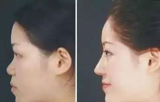 山根低的男人命运