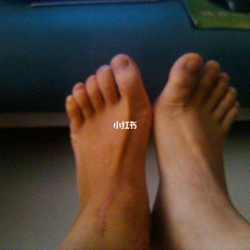 脚趾头齐的男人命运