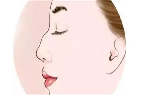 驼峰鼻型的女人命运