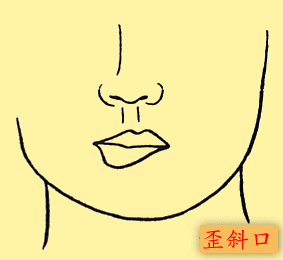 歪嘴人命运