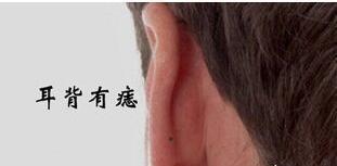 耳朵小有痣的女人命运