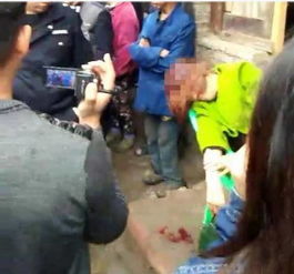 算命肚脐上长瘊子女人命运