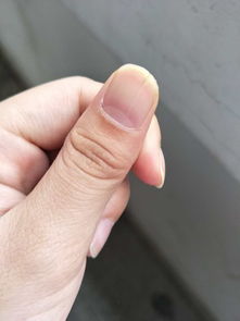指甲盖大的人命运